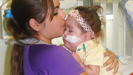 Una positiva evaluación presentan siamesas separadas en Clínica Alemana