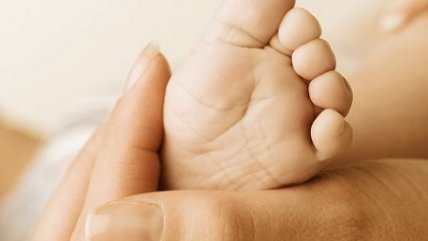 Expertos y casos de siameses: Operar apurado a estos niños tiene mayor letalidad