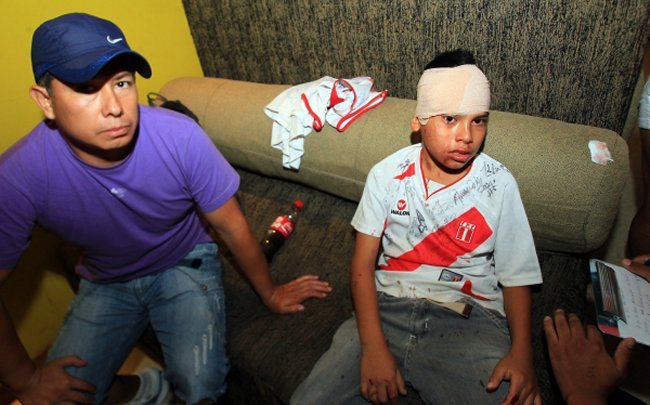 Prensa peruana denunció que hinchas chilenos agredieron a mujeres y niños Prensa peruana denunció que hinchas chilenos agredieron a mujeres y niños