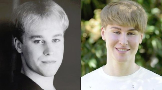 Fan de Justin Bieber se sometió a cirugía para parecerse a su ídolo Fan de Justin Bieber se sometió a cirugía para parecerse a su ídolo
