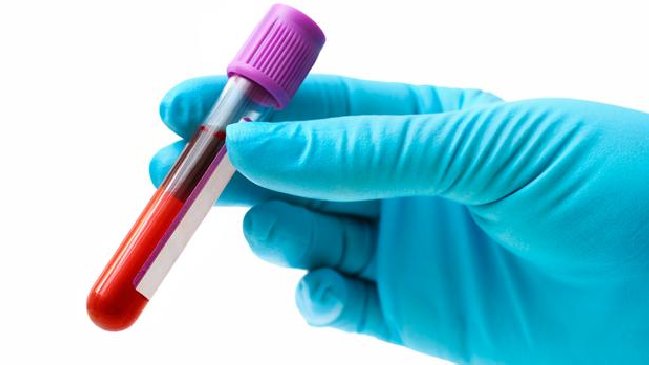 Nuevos avances para detectar cáncer de mama con prueba de sangre Nuevos avances para detectar cáncer de mama con prueba de sangre