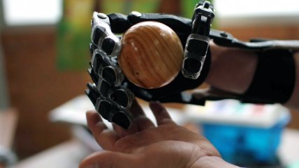   Teletón entregó primera prótesis 3D a un paciente 