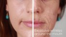 Los efectos del tabaquismo en el rostro de las personas