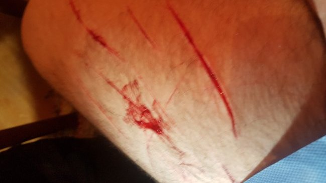 Comunidad Judía y Movilh denuncian ataque a joven 