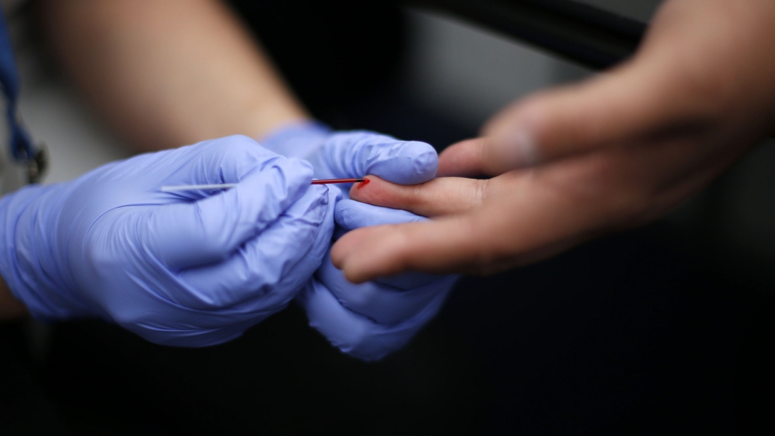 Gobierno lanzó plan nacional contra el VIH: Se compraron 200 mil test rápidos