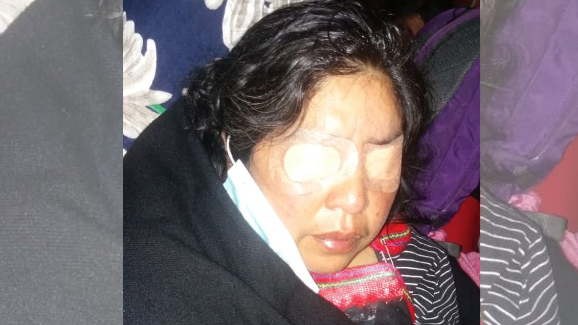 Madre de Camilo Catrillanca resultó con ceguera temporal por gas pimienta Madre de Camilo Catrillanca resultó con ceguera temporal por gas pimienta