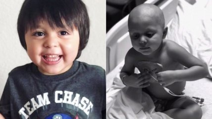 Pequeño de cuatro años superó tratamiento contra leucemia tras 93 quimioterapias    Pequeño de cuatro años superó tratamiento contra leucemia tras 93 quimioterapias