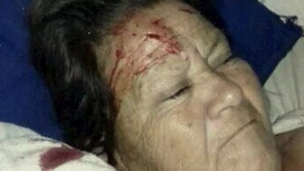  Mujer fue al hospital y le cayó un ventilador en la cabeza  