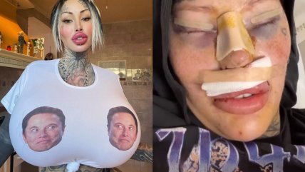 El increíble antes y después de adicta a las cirugías