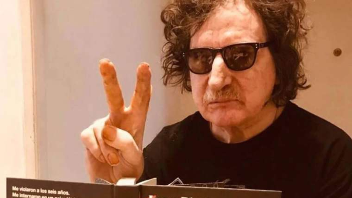 Charly García fue dado de alta: Se recupera de grave quemadura