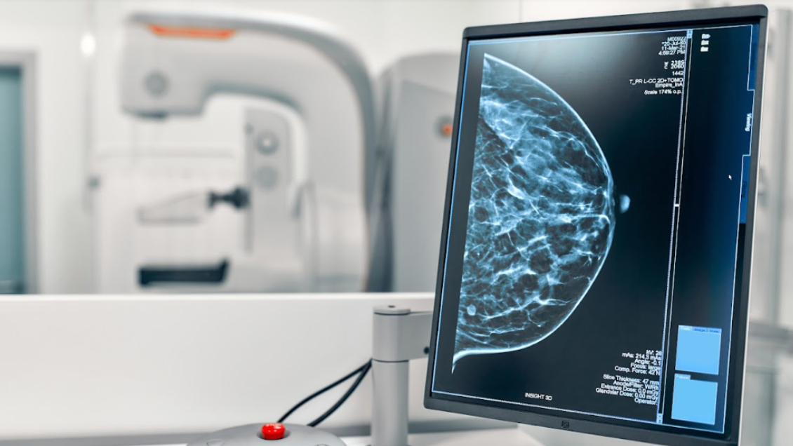 Diputadas RN citan a ministras por alza de lista de espera GES en cáncer de mama y cervicouterino Diputadas RN citan a ministras por alza de lista de espera GES en cáncer de mama y cervicouterino