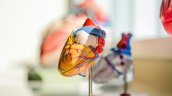 Identifican gen responsable de cardiopatías en personas con síndrome de Down