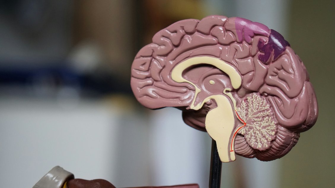 La contaminación del aire está vinculada con el alzhéimer, según estudio La contaminación del aire está vinculada con el alzhéimer, según estudio