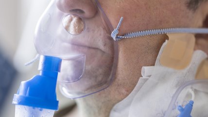   ¿Cómo pudo impactar la colusión del gas medicinal al sistema sanitario en pandemia? 