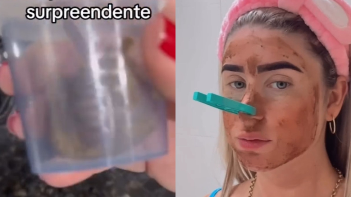Influencer creó mascarilla facial con sus heces: Situación alarmó a los médicos Influencer creó mascarilla facial con sus heces: Situación alarmó a los médicos