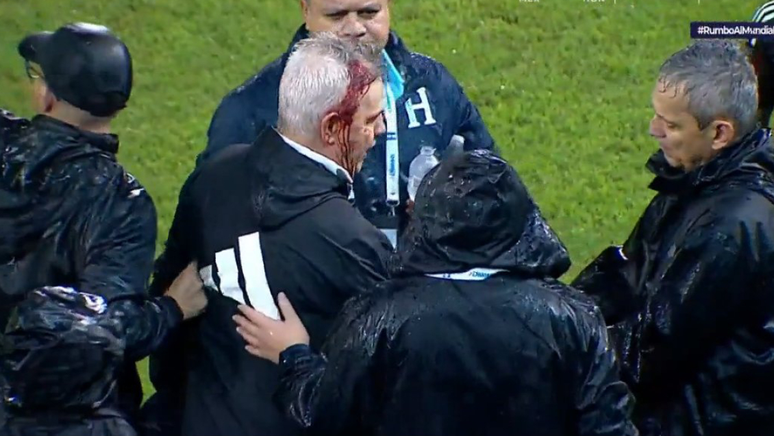 DT de México sufrió grave agresión de hincha y terminó sangrando tras caída ante Honduras DT de México sufrió grave agresión de hincha y terminó sangrando tras caída ante Honduras