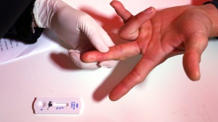   Prevención del VIH: Activista resalta que 