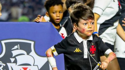   Pequeño hincha de Vasco fue premiado como el mejor hincha en The Best 