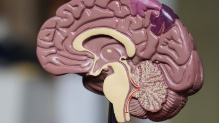   Los microplásticos se pueden acumular más en el cerebro que en el riñón o el hígado 