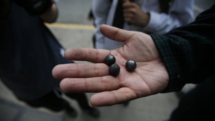   Corte ordenó al Fisco indemnizar a víctima de trauma ocular del estallido 