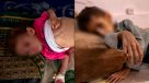 El rostro más silencioso de la guerra: desnutrición infantil en Gaza