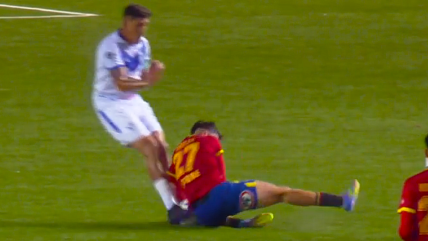   Joven Diego Robles sufrió lamentable lesión en su debut como titular con Unión Española 