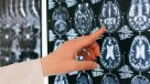 Congreso Futuro: Los relojes cerebrales y su correlación con la edad