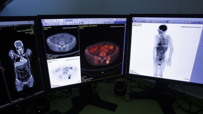 Desarrollan una biopsia líquida que detecta el cáncer colorrectal en fase inicial