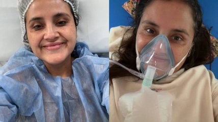  Pamela Leiva revela cirugía estética a la que se sometió hace un año: 