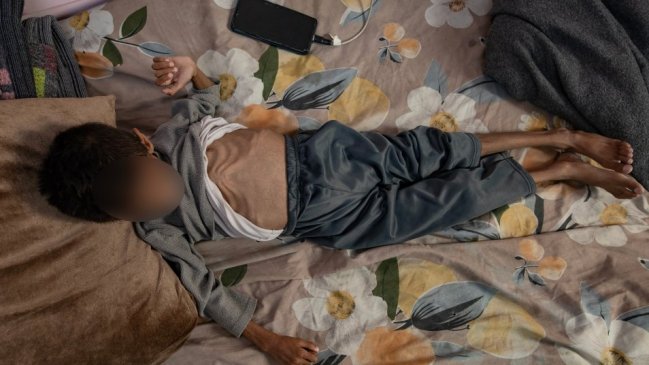 La desnutrición crece en Gaza mientras hay 6.000 camiones con ayuda que no pueden entrar