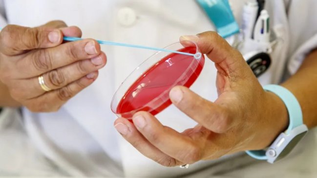 Perú activó alerta epidemiológica por brote de sarampión en Bolivia