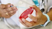 Perú activó alerta epidemiológica por brote de sarampión en Bolivia