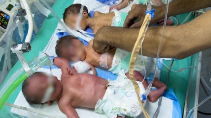 Embarazadas pesando 40 kilos y bebés prematuros compartiendo cunas: El rostro de la crisis en Gaza