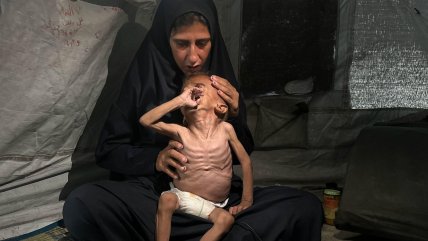   Enfermo y desnutrido: El niño de Gaza que según Israel es fake news 