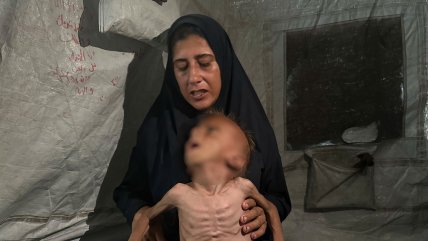  Guagua de seis meses murió por desnutrición en Gaza 