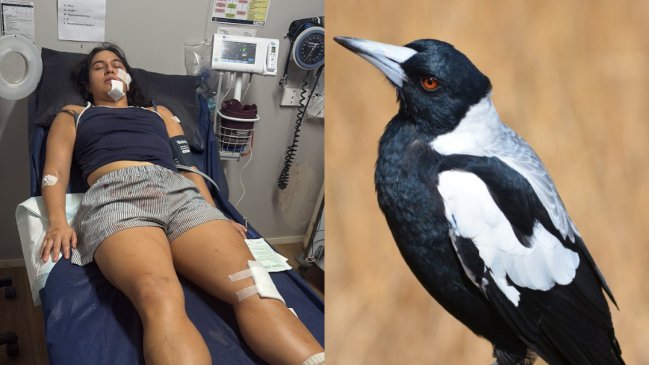 Ataque de urraca deja a chilena gravemente herida en Australia