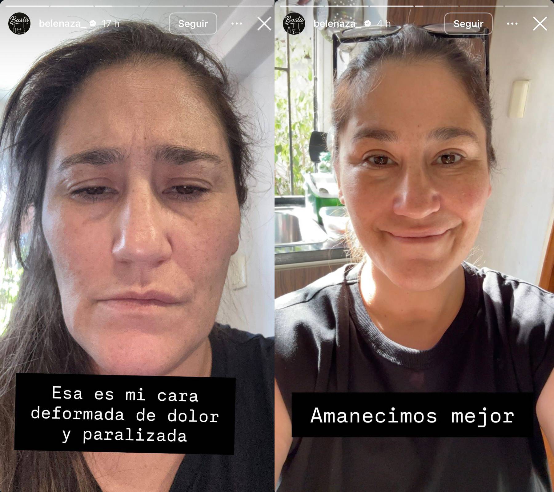 Belén Mora mostró su rostro tras crisis de neuralgia del trigémino