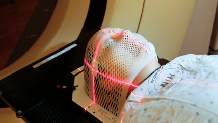   Día Mundial contra el Cáncer: El planeta alcanzará los 22,6 millones de casos en 2030 