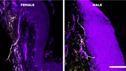   El sistema inmunitario, la causa de que el dolor crónico dure más en las mujeres 