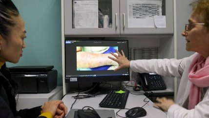 Chile es el primer país de América que está libre de lepra, según la OMS